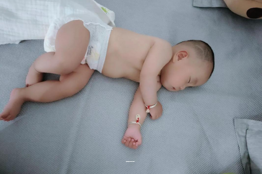 邵阳县宝宝上火有眼屎